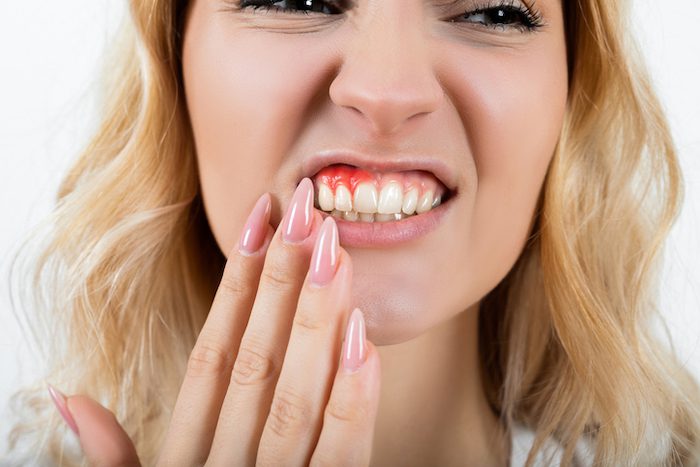 gum disease treatment in marshall, texas