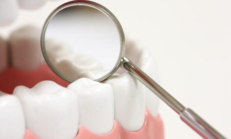 How Fluoride Strengthens Teeth