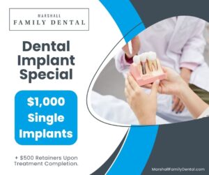 dental implant special