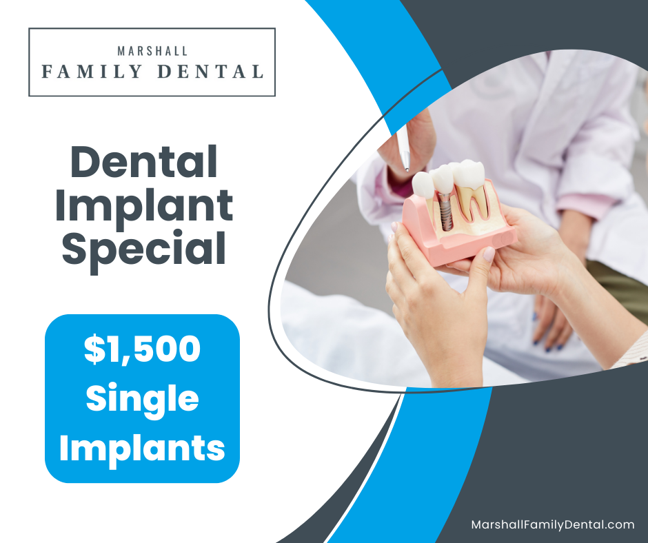 Marshall Implant Offer 2026